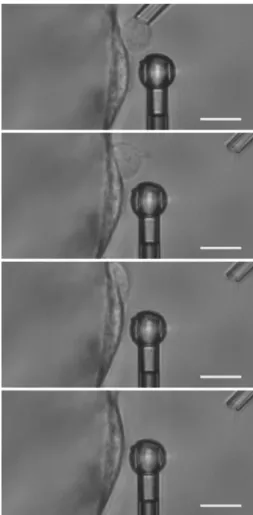 FIGURE 1.11: Profile view of the migration of a human lymphoblast cell on a HAEC. 