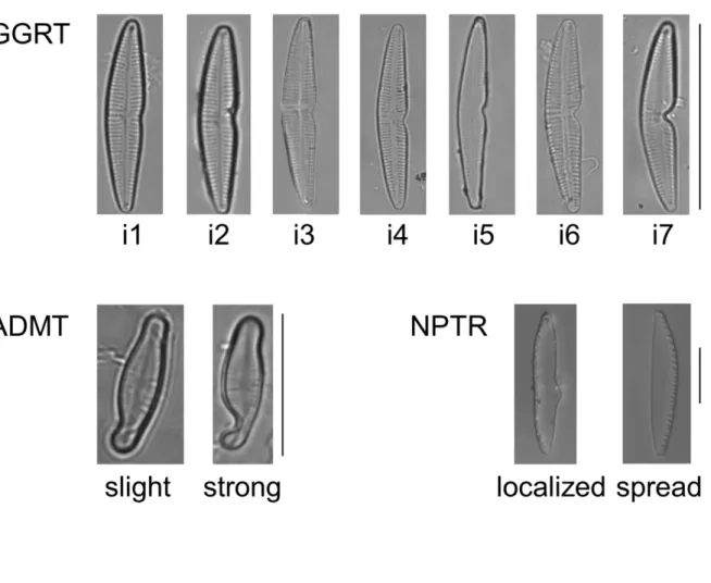 Figure 1. A priori (visual) classification of the deformity. The deformity index ranks from i1 (least  deformed) to i7 (most deformed) for GGRT (scale bar=30 µm), from slight to strong in ADMT (scale  bar=10µm)