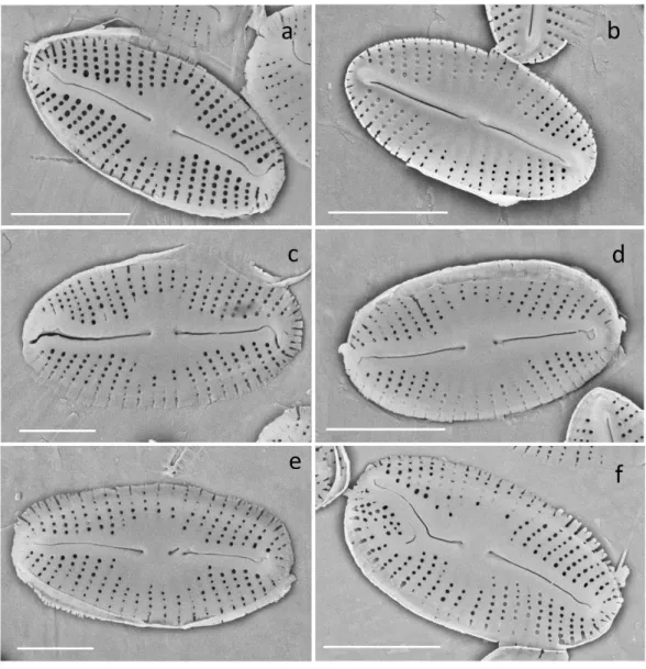 Figure  6.  Mayamaea  atomus  SEM  images  of  normal  and  deformed  valves.  (a)  External  valve  view,  typical valve raphe apices not equally formed