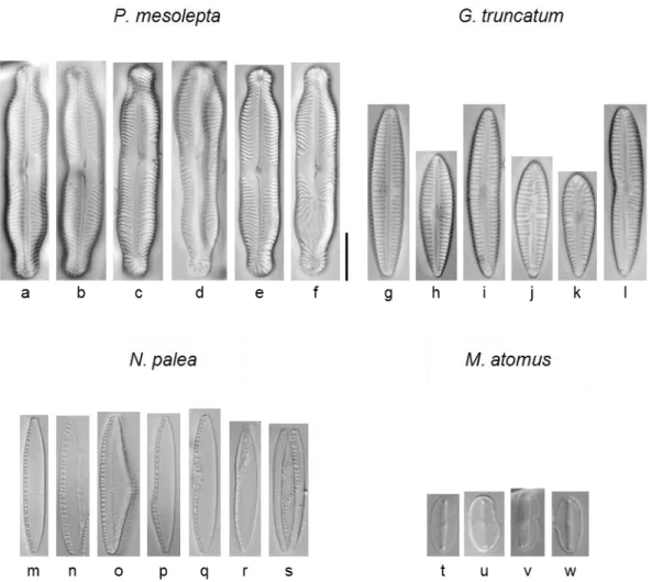 Figure  1.  Examples  of  morphological  aberrations  observed  on  valves  for  the  four  diatom  species  studied