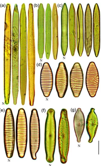 Fig. 2. Normal and deformed frustules of the diatoms Ulnaria ulna (a-c), Diatoma vulgaris, (d,e), 