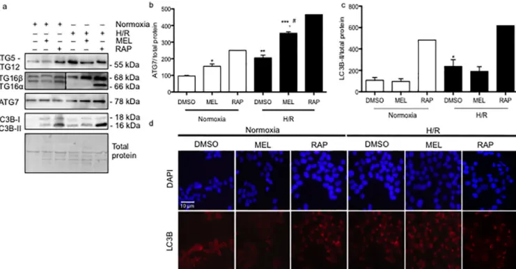 Fig 3. Hypoxia/reoxygenation and melatonin differentially regulate autophagosome formation in BeWo cells