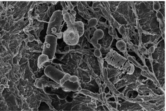 Fig. 2. Where are they from? Electron microscopy image from bac- bac-teria on human skin.