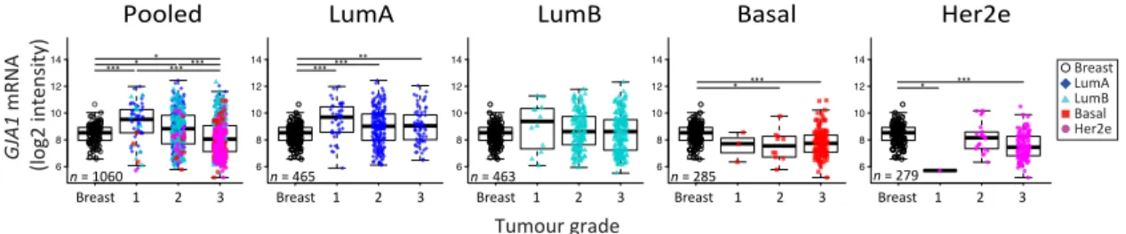 Figure 6. GJA1 mRNA level is downregulated with grade in clinical samples only in pooled tumors