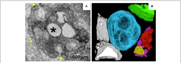 FIGURE 3 | TEM analysis and 3D reconstruction of MNSV-induced altered mitochondria. (A) TEM image showing altered mitochondria