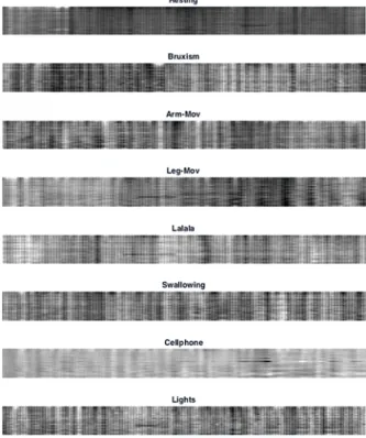 Figure  11.10  illustrates  the  2D  empirical  Littlewood-Paley  wavelet  transform  reconstruction of a signal by using this algorithm