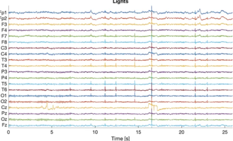 Fig. 11.7. Example of light artefacts. The figure shows that spike waveforms are exhibited  