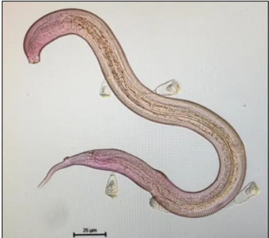 Figure 6. Picture of a nematode (Desmodora sp.) with epibionts. Credit @Claire Michelet