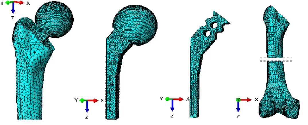 Fig. 1 Finite element meshes of hip prosthesis components: hip spacer, implant spacer, endoskeleton and 
