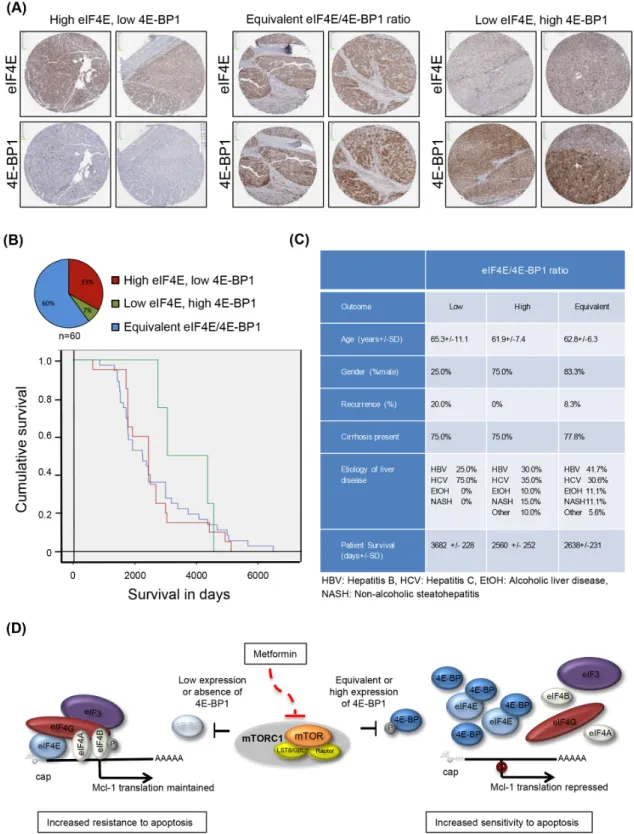 Figure 5: Patient HCC tumors demonstrate a variety of eIF4E and 4E-BP1 expression ratios