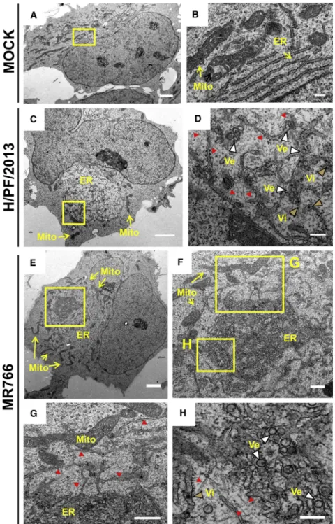 Figure 5. Ultrastructural Analysis of ZIKV-In- ZIKV-In-fected hNPCs