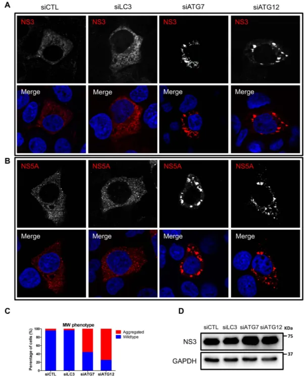 Figure 6.  The impact of LC3, ATG7 or ATG12 silencing on membranous web phenotype. (A,B) Huh7-