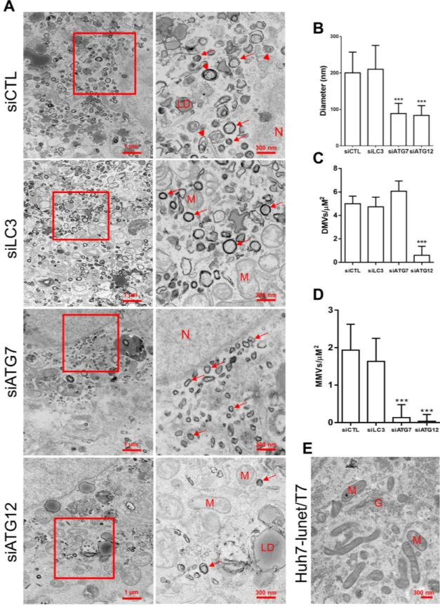 Figure 7.  The impact of LC3, ATG7 or ATG12 silencing on membranous web ultrastructure