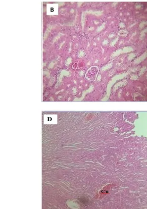 Figure 6: Histological sections of liver tissue with a single dose of 118 mg/kg: control group (A), treated groups; (B):  After 24h ;(C): After 5 days; (D): After 28 days
