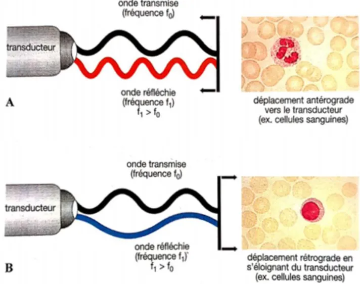 Figure 4 : schéma des ondes ultrasonores réfléchies par un objet en mouvement (ici des  cellules sanguines) lorsqu’il se déplace vers la sonde (A) et lorsqu’il s’en éloigne (B) (Nautrup 
