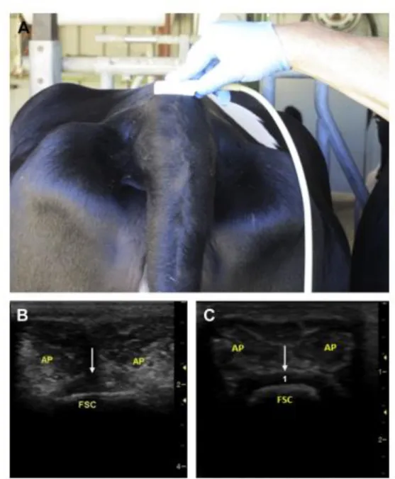 Figure 15 : placement de la sonde pour la réalisation d’un bloc épidural échoguidé (A) et  images échographiques correspondantes chez une vache (B) et un veau (C)