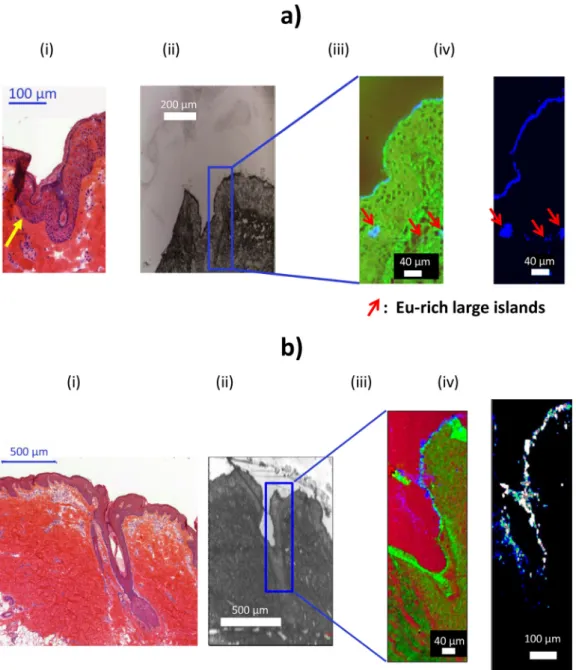 Fig.  7. Coupled histological/Raman/photoluminescence observations of porcine ear skin explants: a) after application of a Eu  3 +  solution