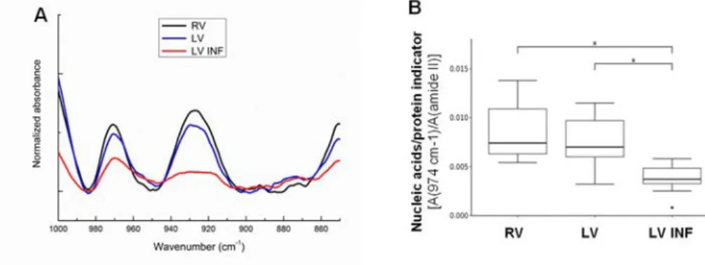 Figure 3. FTIR analysis of the nucleic acids in the human ventricle samples. Line graphs showing the  1000–850 cm –1  average FTIR spectra corresponding to the signal of nucleic acids in the RV, LV, and 