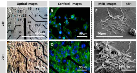 Fig. 6.  In vi.tro cytotoxicity assay &amp; cell morphology assessment. Optical images showing SH-SYSY cult1vated on top of the PEDOT:CNF coated microelectrodes array  for (A) 24 h and (C) 72 h