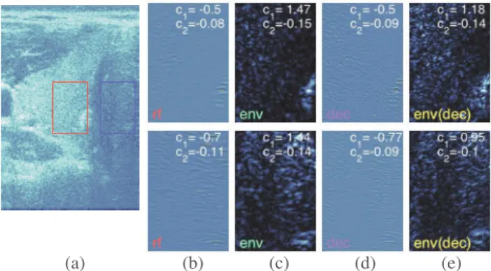 Fig. 4. Results for real data. Thyroid image (a, B-mode image) and rf (b), env (c), dec (d), env(dec) (e) images of red (top row) and blue (bottom row) patch, with estimates c 1 , c 2 .