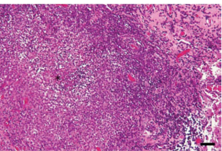 Figure 7. Histologie de biopsie méningée d'un furet présentant un  pyogranulome cérébral à coronavirus