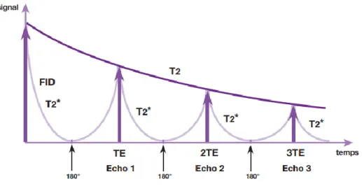 Figure 18: Courbe en T2 &#34;vrai&#34; (9) 