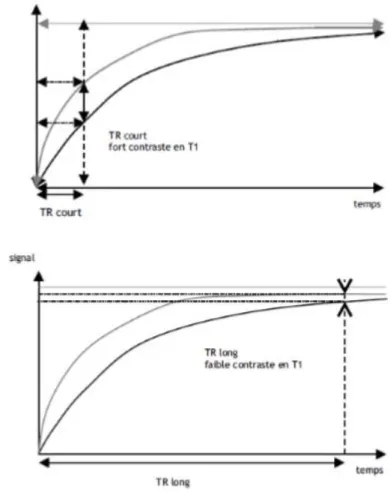 Figure 20: Influence du TR sur la pondération en T1 d'une séquence (10) 