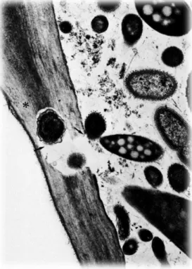 Figure 12 : Image de microscopie électronique à transmission de digestion de fibres végétales (*)  par les  bactéries (→) du rumen chez un mouton (tirée de (Thivend et al
