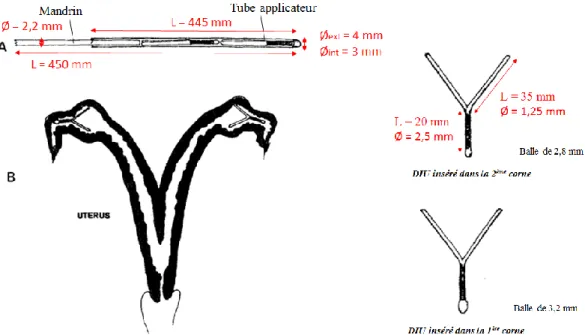 Figure 14 : DIUB® testé par Turin en 1997 et son materiel d’insertion (Turin et al., 1997)