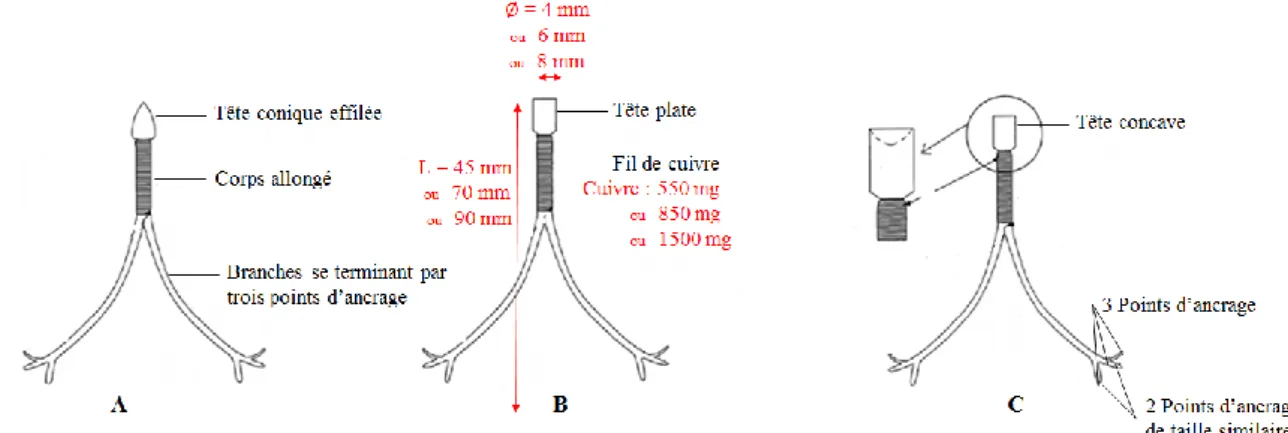 Figure 16 : Vue latérale d'un DIU se terminant en deux points d’ancrage (Turin, 2013)