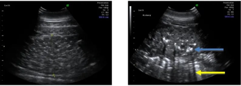 Figure 13 : Reconstruction en trois dimensions d’un scanner incluant les côtes caudales et les corps  vertébraux lombaires