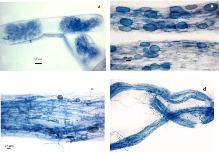 Figure 3 : Structures caractéristiques des champignons mycorhiziens arbusculaires. (a)  Arbuscules intercellulaires (b) vésicules intraradiculaires (c) Hyphes intraradiculaires (d) hyphes 