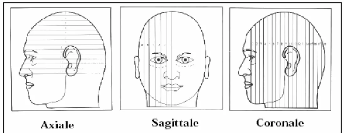 Figure 1.6: Les trois axes de coupe pour la visualisation du cerveau. [GER 99] 