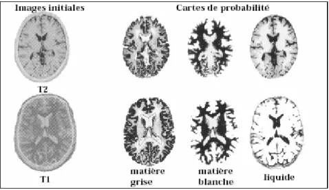 Figure 2.4 : Segmentation par méthode bayésienne.  3.3.1.2. Segmentation Markovienne 