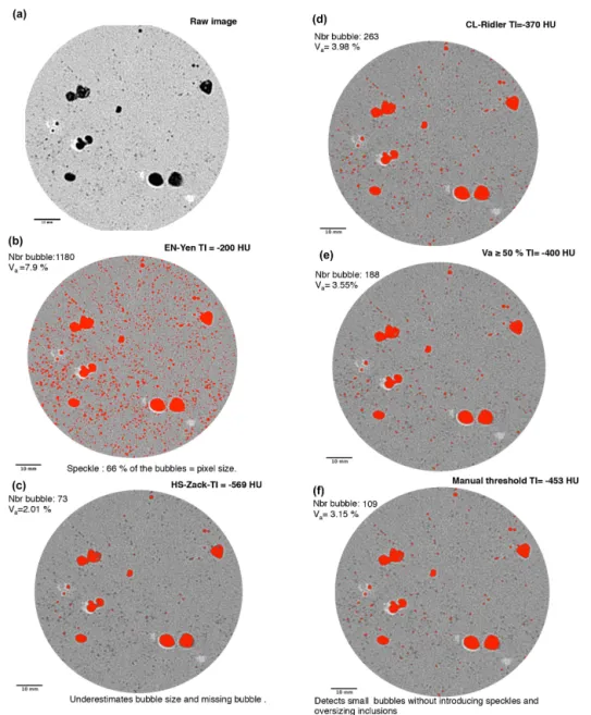 Figure 2. (a) Raw transversal slice where grey pixels represent ice, black pixels represent air, and darker grey pixels are pixel-containing air