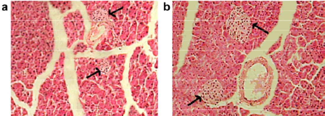 Figure 21 : Photomicrographie du pancréas d’un rat diabétique (a) et d’un autre rat diabétique traité par l’extrait riche en flavonoïdes des graines d’Eugenia jambolana (b)