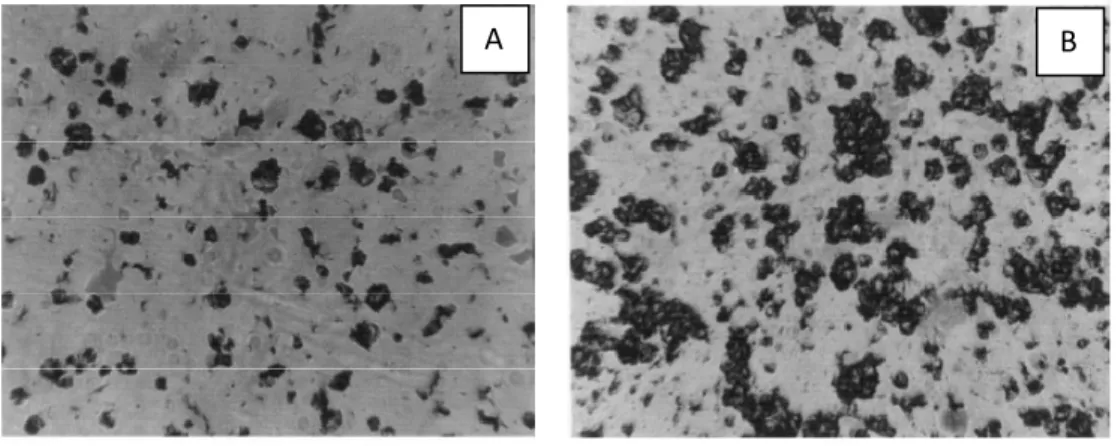 Figure I.9 : Micrographies montrant l’endommagement de la surface d’un verre impacté 