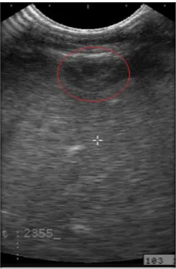 Figure 23 : Aspect échographique d'une veine ombilicale normale chez un veau de 3 semaines (cercle rouge)  (Nouvel, 2015) 
