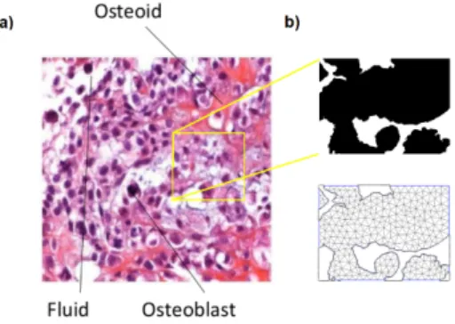 Figure 1: a) Histological section of osteosarcoma stained with H&amp;E ; b) Binary image and a  correspond-ing coarse unstructured mesh for the finite element methods implementation.