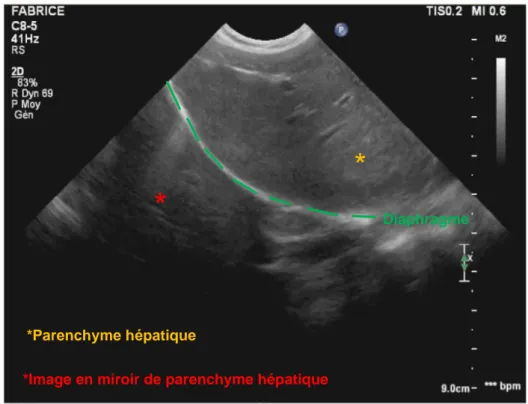 Figure  15  :  Artéfact d’image en miroir. Parenchyme hépatique visualisé de façon artéfactuel sous le  diaphragme (Banque d’image ENVT)