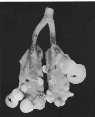 Figure 8 : Poumons d'une tortue verte juvénile (Chelonia mydas) atteins de fibropapillomatose, d'après Herbst et al