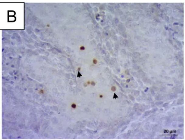 Figure 4: Effect of the MIX before or after ozonation on cell proliferation and apoptosis in testes  from 15.5 days old rat fetuses in organ culture for 3 days
