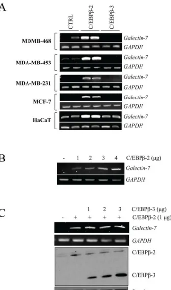 Figure 1. C/EBPb-2 induces galectin-7 mRNA levels in breast cancer cell lines. (A) RT-PCR analysis showing increased expression of galectin-7 in human breast cancer cells after transfection with an expression vector encoding C/EBPb-2