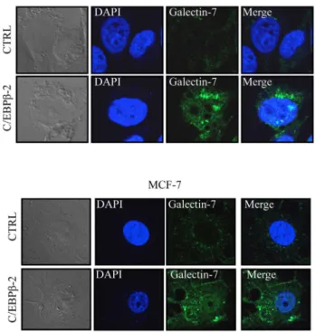 Figure 2. Protein expression of galectin-7 in breast cancer cell lines. MCF-7 or MDA-MB-231 cells were transfected with an expression vector encoding C/EBPb-2 before cell fixation and permeabilization