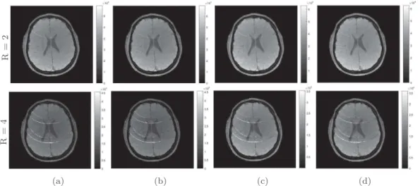 Fig. 4: Reconstructed pMRI brain images by : (a) the SENSE method, (b) the proposed sparse model , (c) the Bayesian ℓ 2