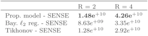 Table 3: Real data : sparsity level for the reconstructed Slices. R = 2 R = 4 SENSE 29080 29082 Prop