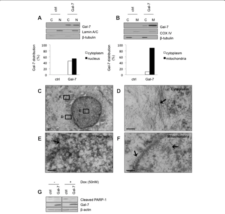 Figure 3 Subcellular distribution of gal-7 in MCF-7 cells. (A) Cytosolic and nuclear fractions were purified from control (sr α) cells and MCF-7 cells expressing gal-7