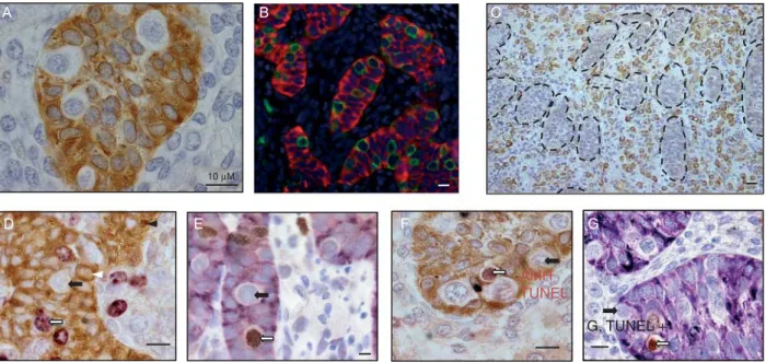 Figure 2 Immunohistological features of human fetal testis explants after culture. (A) AMH expression