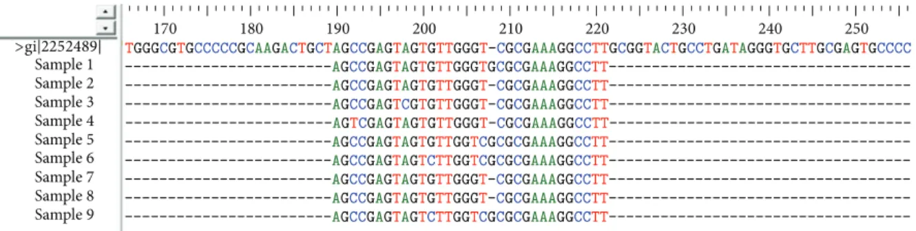 Figure 1: Multiple sequence alignment of AUG domain using ClustalW program. After sequencing, nine sequences comprising the AUG (34 nucleotides) were aligned using ClastalW program