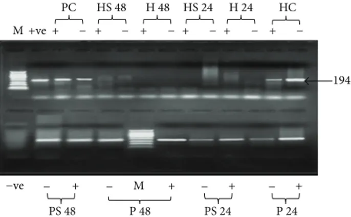 Figure 4: Agarose gel electrophoresis of HCV nested PCR products in two different types of cells treated with S-ODN1 and its derivative